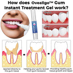 Charger l'image dans la galerie, Essence de blanchiment des dents LUNOON™- Gel de traitement instantané