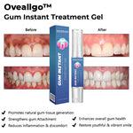 Charger l'image dans la galerie, Essence de blanchiment des dents LUNOON™- Gel de traitement instantané