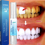 Charger l'image dans la galerie, Essence de blanchiment des dents LUNOON™- Gel de traitement instantané