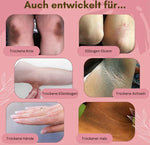 Charger l'image dans la galerie, FootCare™ – Contre les mycoses, l’eczéma et la peau craquelée, régénérant, hydratant et à l’arnica [1 + 1 Gratuit]
