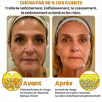 Charger l'image dans la galerie, BOTOX- Réduisez les Rides en 2 Minutes - Sérum Anti-Âge Rapide et Efficace - Économisez Temps et Argent

