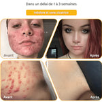 Charger l'image dans la galerie, CRÈME AU VENIN D'ABEILLE – RÉVOLUTION SKINCARE POUR UNE PEAU PARFAITE
