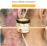 Charger l'image dans la galerie, CRÈME AU VENIN D'ABEILLE – RÉVOLUTION SKINCARE POUR UNE PEAU PARFAITE
