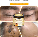 Charger l'image dans la galerie, CRÈME AU VENIN D'ABEILLE – RÉVOLUTION SKINCARE POUR UNE PEAU PARFAITE
