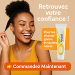Charger l'image dans la galerie, Fevicid Crème – Anti-Mycoses, Tâches Noires et Boutons de Rasage
