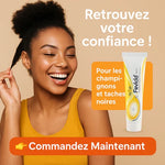 Charger l'image dans la galerie, Fevicid Crème – Anti-Mycoses, Tâches Noires et Boutons de Rasage - GN
