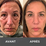 Charger l'image dans la galerie, BOTOX- Réduisez les Rides en 2 Minutes - Sérum Anti-Âge Rapide et Efficace - Économisez Temps et Argent
